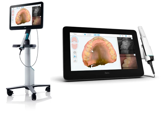The iTero Lumina intraoral 3D scanner