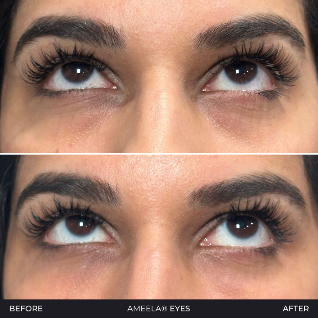 This image has an empty alt attribute; its file name is Ameela-Eyes--1024x1024.jpg